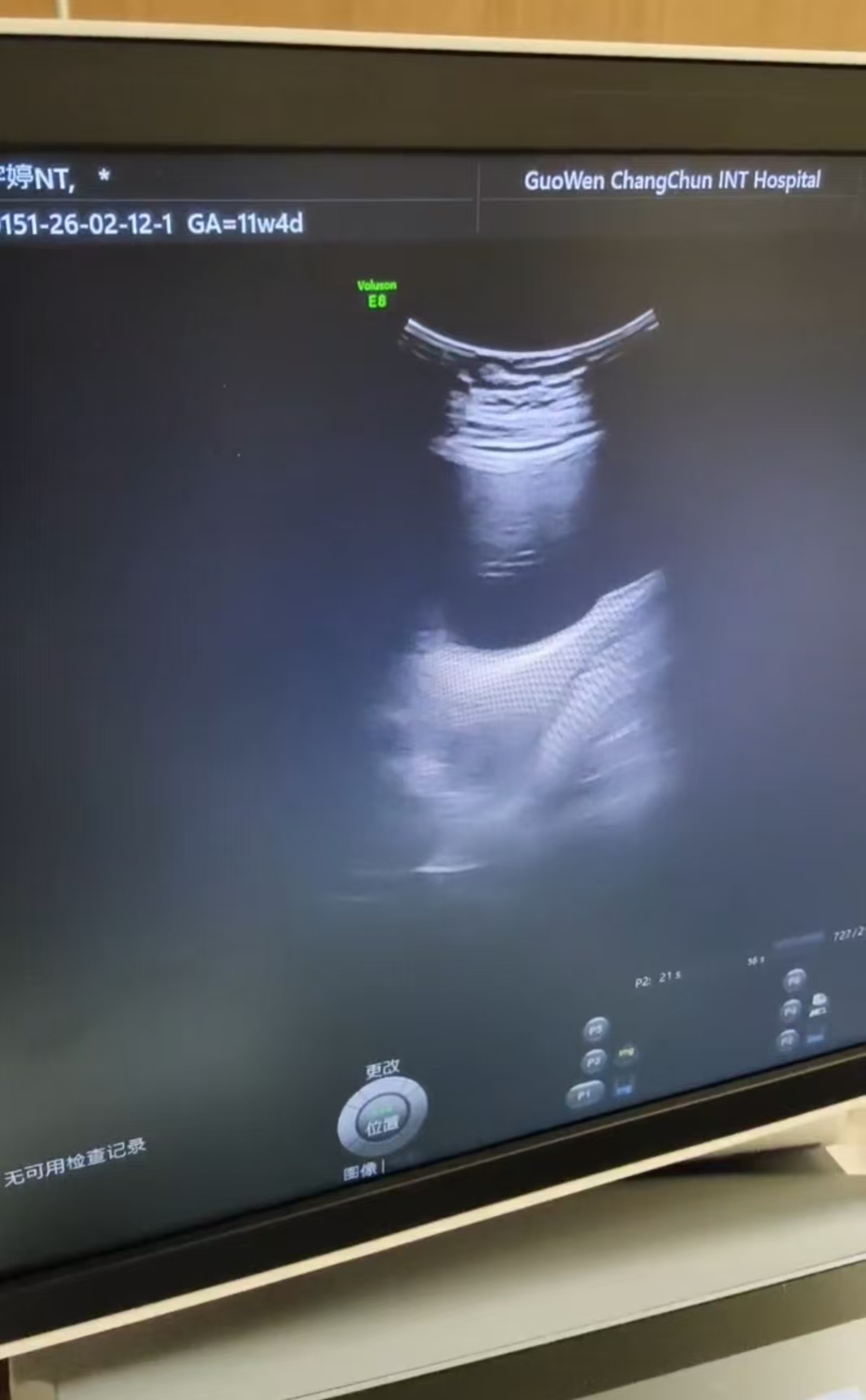 GE RAB6-D彩超探头维修